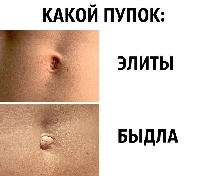 кА___ой пупою 55 ЭЛИТЫ БЫДЛА