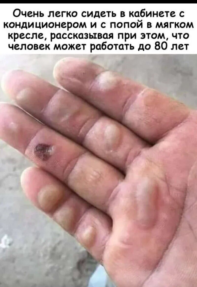 Очень легко сидеть в кабинете с кондиционером и с попой в мягком кресле рассказывая при этом что человек может работать до 80 лет и ц