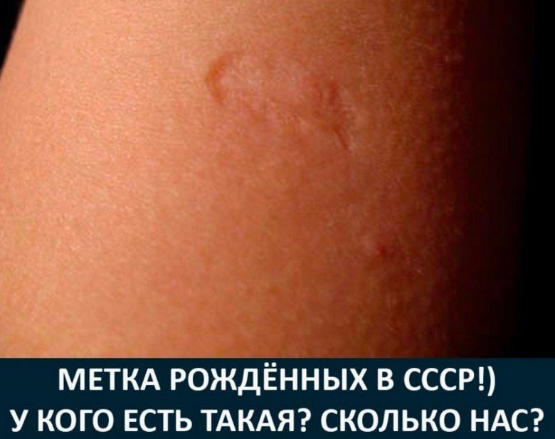 МЕТКА РОЖДЁННЫХ В СССР У КОГО ЕСТЬ ТАКАЯ СКОЛЬКО НАС