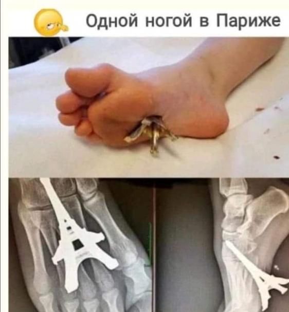 Одной ногой в Париже