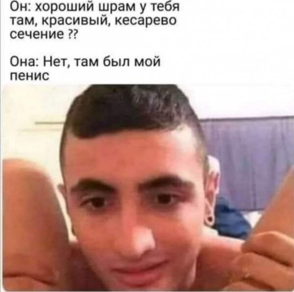 Он хороший шрам у тея тамкрасивыйкесарево сечение Она Нет там был мой пенис