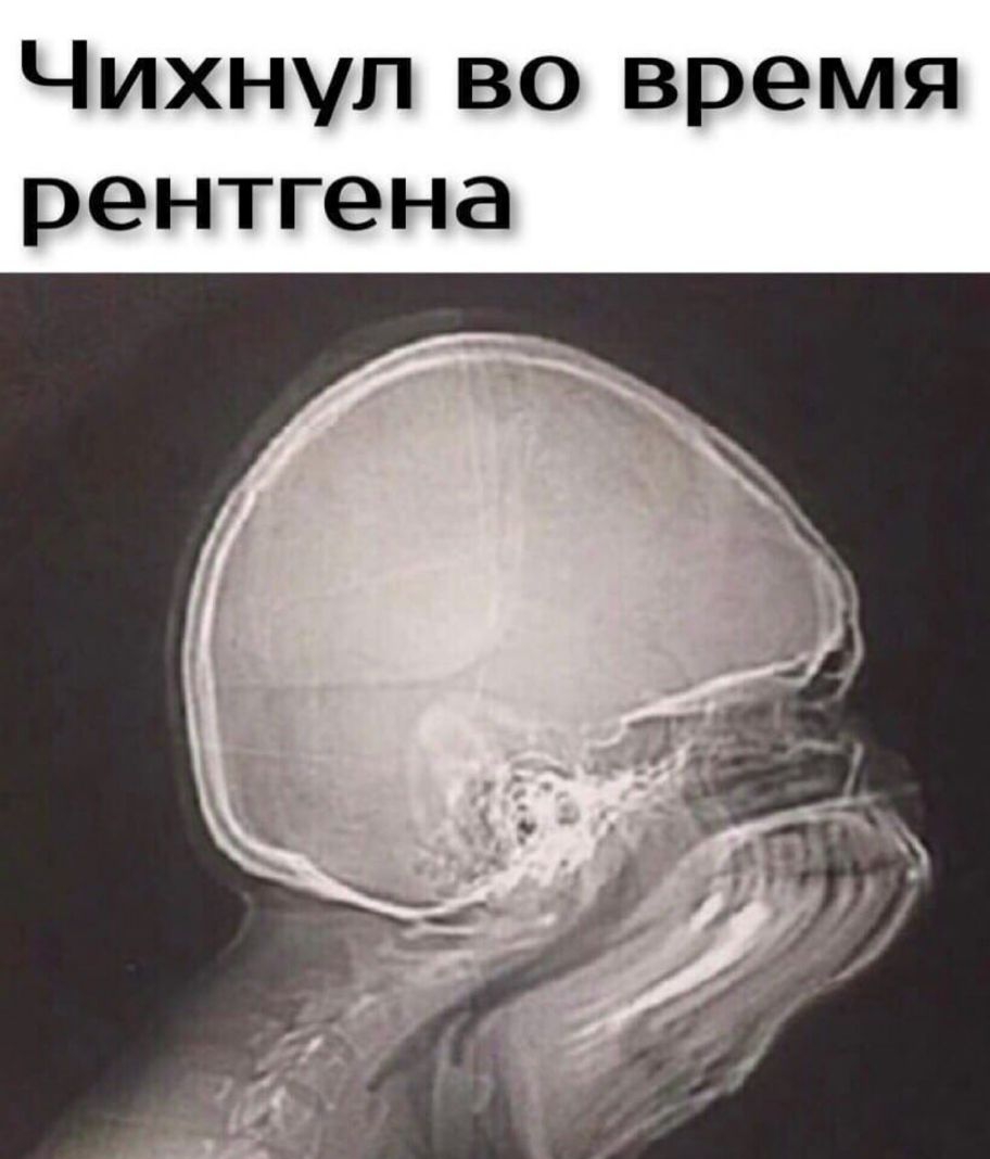 Чихнуп во время рентгена