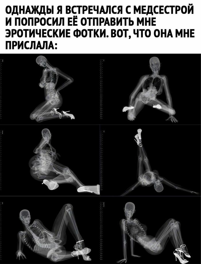 ОДНАЖДЫ Я ВЕТРЕЧАЛСЯ С МЕДСЕСТ РОЙ И ПОПРОСИЛ ЕЕ ОТПРАВИТЬ МНЕ ЭРОТИЧЕСКИЕ ФОТКИ ВОТ ЧТО ОНА МНЕ ПРИСЛАЛА