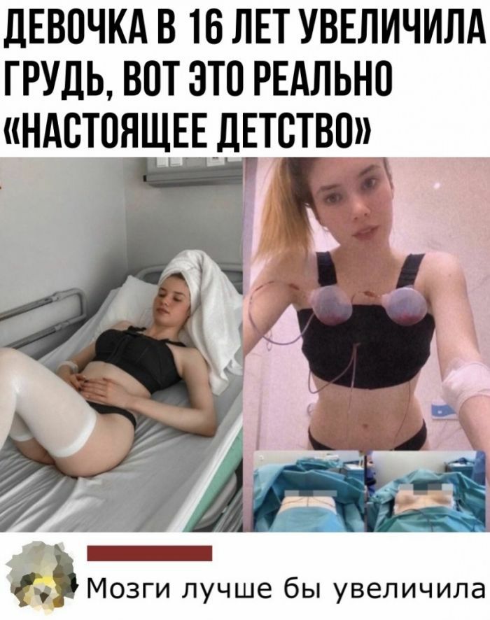 ДЕВОЧКА В 16 ЛЕТ УВЕЛИЧИЛА ГРУДЬ вот это РЕАЛЬНО НАСТОЯЩЕЕ _ДЕТСТВО Мозги лучше бы увеличила