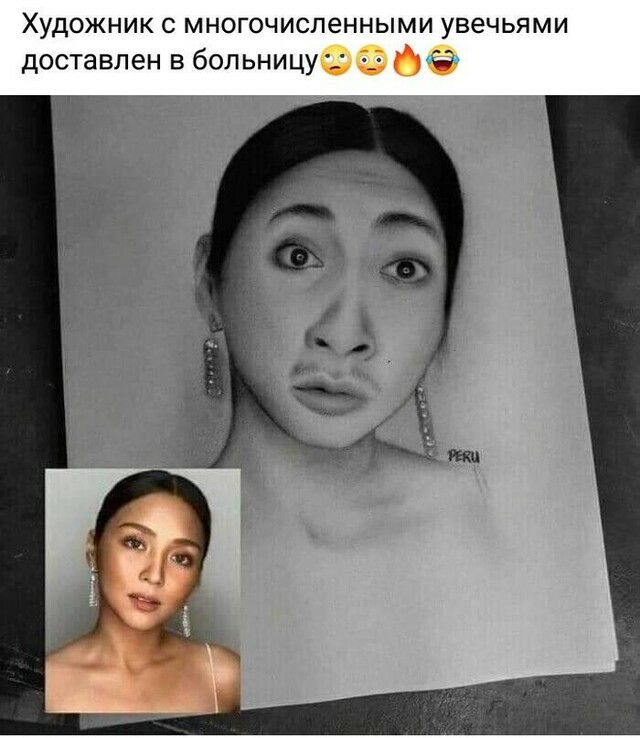 Художник с многочисленными увечьями доставлен в больницу Ё