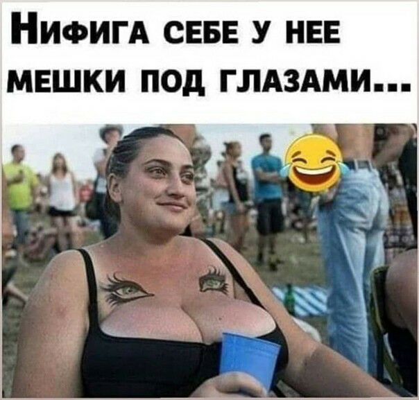 НИФИГА СЕБЕ У НЕЕ МЕШКИ ПОд ГЛАЗАМИ