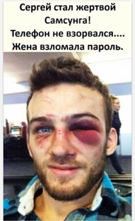 Сергей сгал жертвой Самсунга Телефон не взорвался __К_ена взлетела пароль
