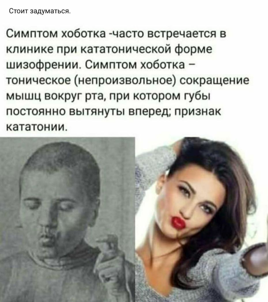СТОИТ ЗЗДУМЭТЬСЯ Симптом хоботка часто встречается в клинике при кататонической форме шизофрении Симптом хоботка тоническое непроизвольное сокращение мышц вокруг рта при котором губы постоянно вытянуты вперед признак кататонии