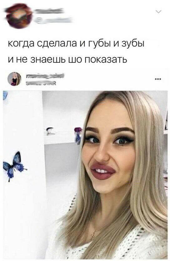 от когда сделала и губы и зубы и не знаешь шо показать эт