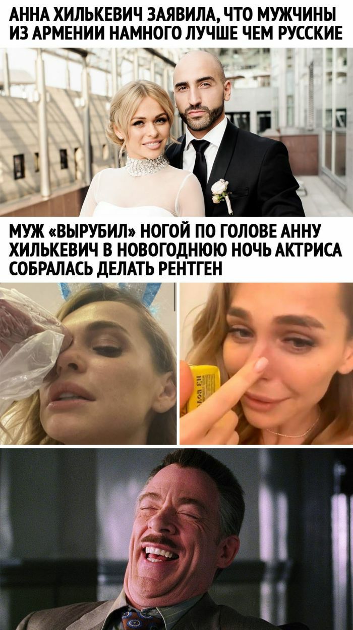 АННА ХИЛЬКЕВИЧ ЗАЯВИЛА ЧТО МУЖЧИНЫ ИЗ АРМЕНИИ НАМНОГО ЛУЧШЕ ЧЕМ РУССКИЕ МУЖ ВЫРУБИЛ НОГОЙ ПО ГОЛОВЕ АННУ ХИЛЬКЕВИЧ В НОВОГОДНЮЮ НОЧЬ АКТРИСА СОБРАЛАСЬ дЕЛАТЬ РЕНТГЕН