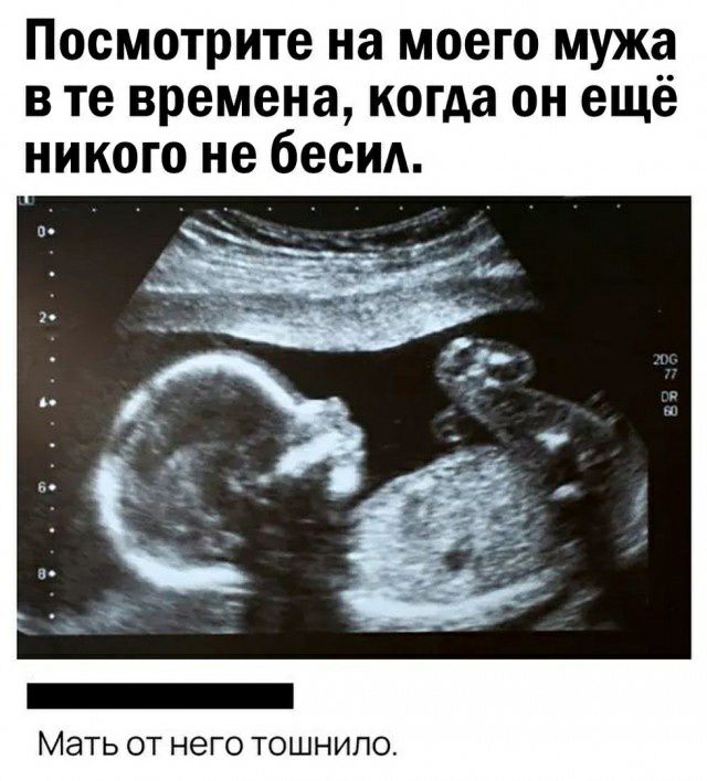 Посмотрите на моего мужа в те времена когда он еще никого не бесид МЭТЬ ОТ НЕГО ТОШНИПО