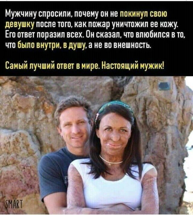 Мужчину спросили почему он не покинул свою девушку после тогокак пожар уничтожил ее кожу Его ответ поразил всех Пи сказал что влюбился в то что было внутри в душу а не во внешность Самый лучший ответ в мире Настоящий мужик