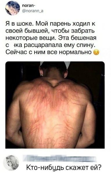поган чттгпчп Я в шоке Мой парень ходил к своей бывшей чтобы забрать некоторые вещи Эта бешеная с ка расцарапала ему спину Сейчас с ним все нормально Кто нибудь скажет ей
