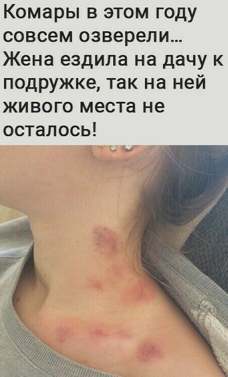 Комары в этом году совсем озверели Жена ездила на дачу к подружке так на ней живого места не осталось