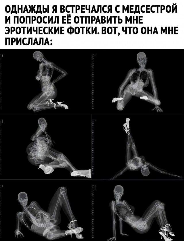 ОДНАЖДЫ Я ВСТРЕЧАЛСЯ С МЕДСЕСГРОИ И ПОПРОСИЛ ЕЁ ОТПРАВИТЬ МНЕ ЭРОТИЧЕСКИЕ ФОТКИ ВОТ ЧТО ОНА МНЕ ПРИСЛАЛА