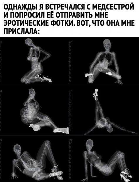 ОДНАЖДЫ Я ВСГРЕЧАЛСЯ С МЕДСЕСГРОЙ И ПОПРОСИЛ ЕЕ ОТПРАВИТЬ МНЕ ЭРОТИЧЕСКИЕ ФОТКИ ВОТ ЧТО ОНА МНЕ ПРИСЛАЛА