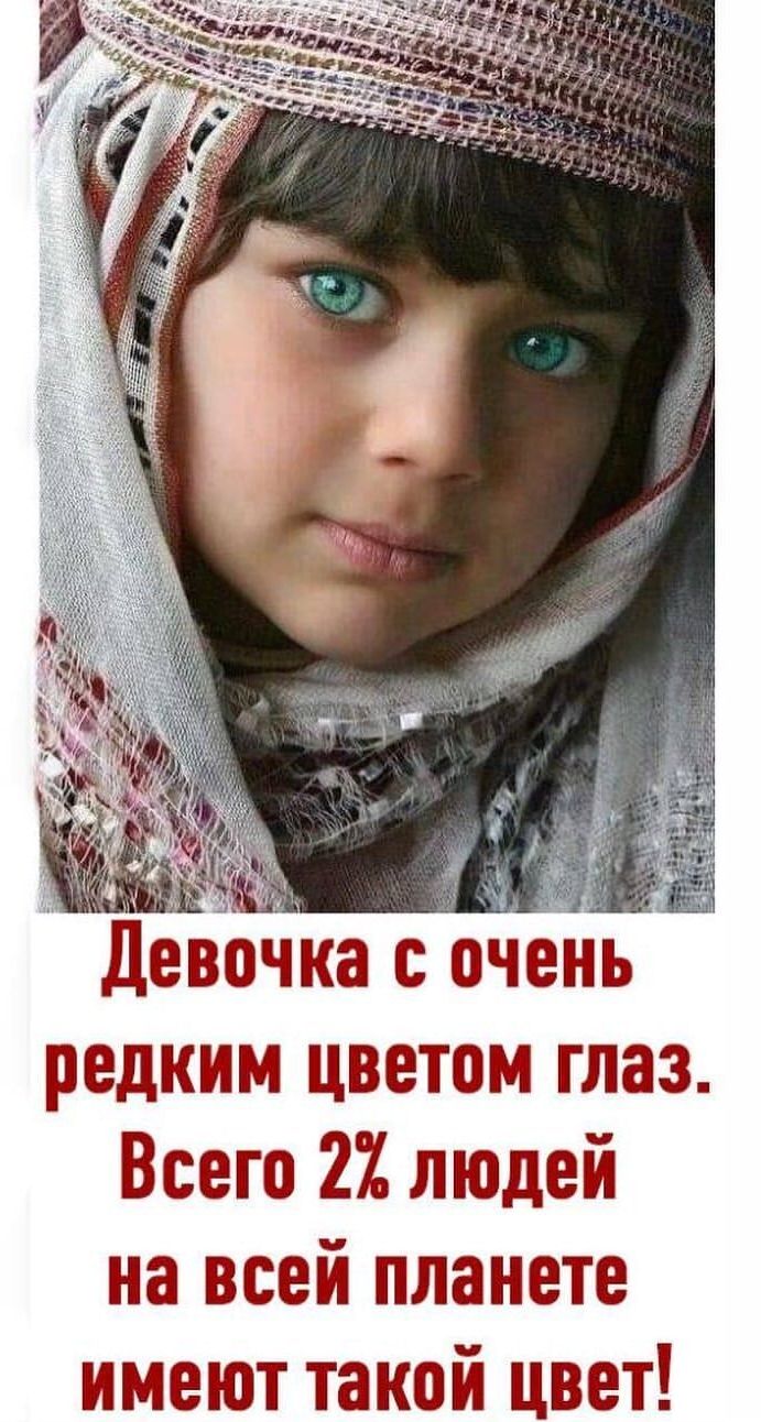 Девочка с очень редким цветом глаз Всего 2 людей на всей планете имеют такой цвет