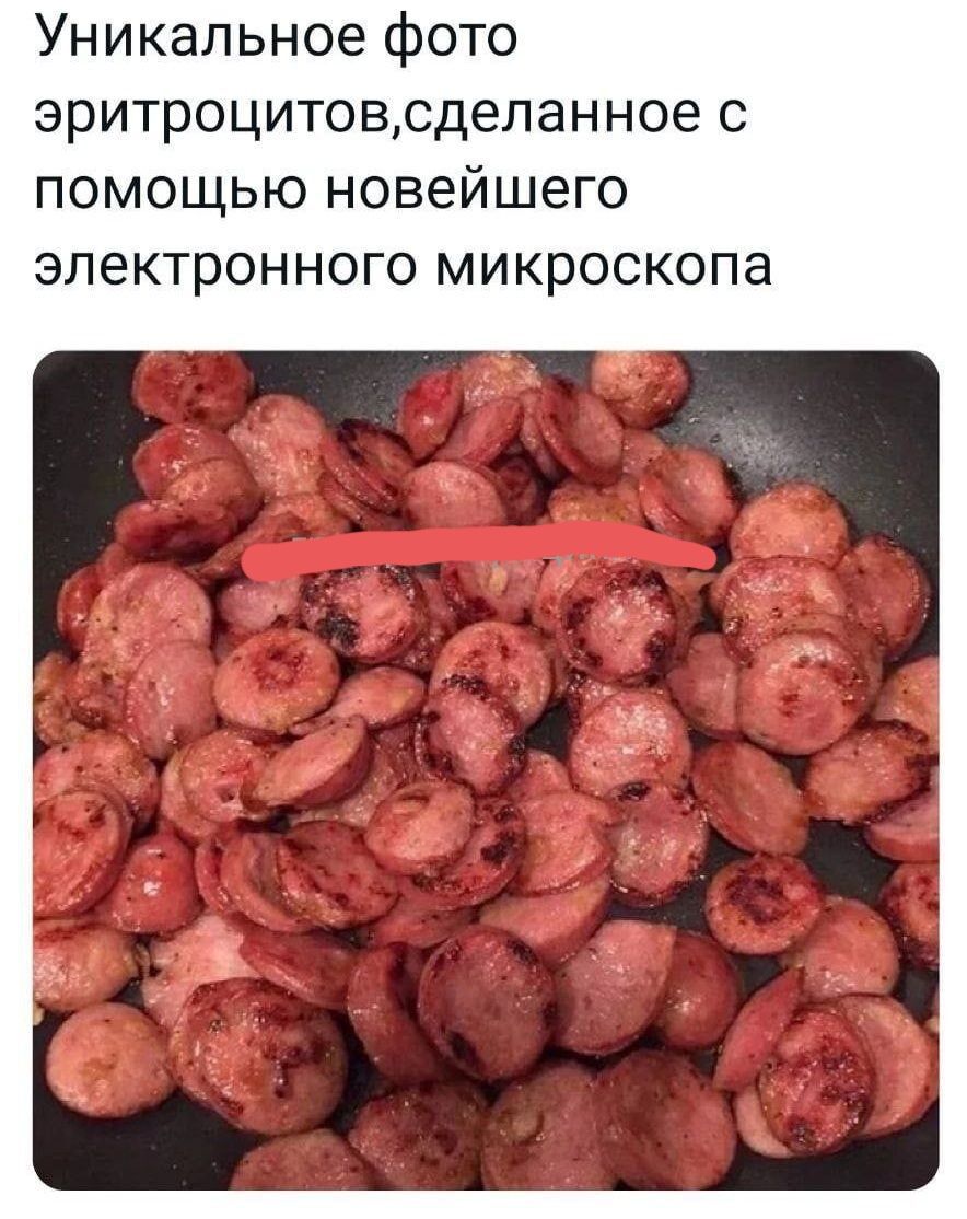 Уникальное фото эритроцитовсделанное с помощью новейшего электронного микроскопа