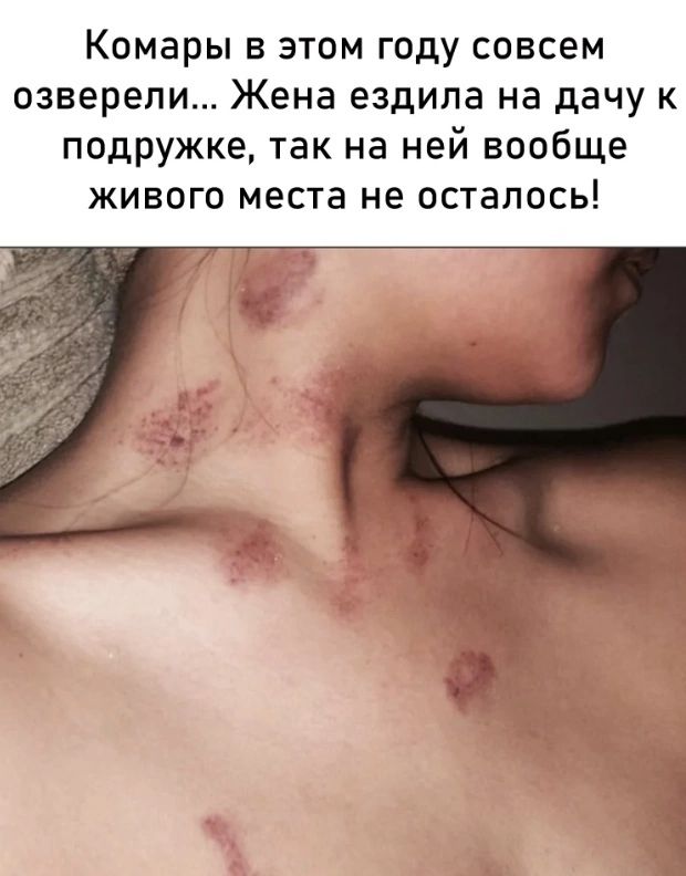 Комары в этом году совсем озверели Жена ездила на дачу к подружке так на ней вообще живого места не осталось