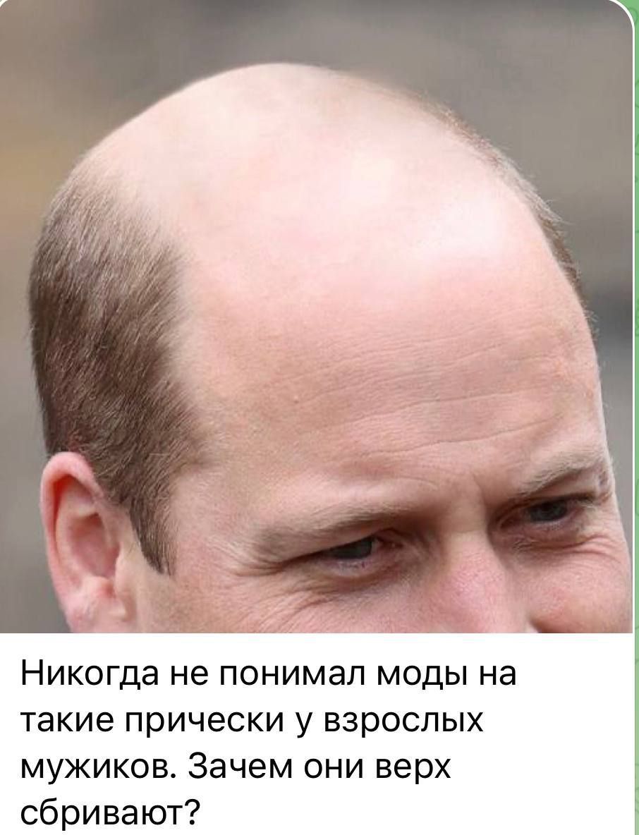 Никогда не понимал моды на такие прически у взрослых мужиков Зачем они верх сбривают