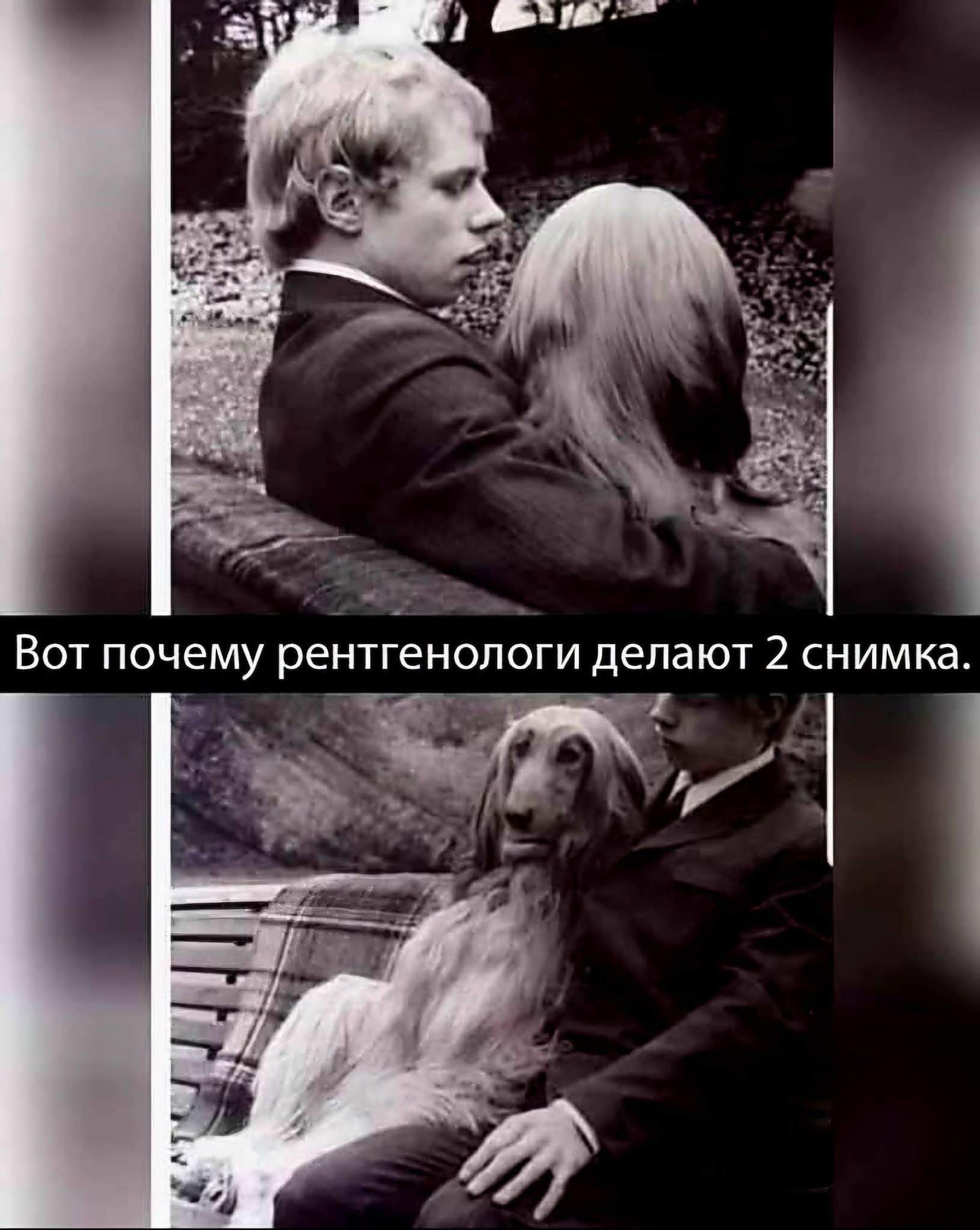 Вот почему рентгенологи делают 2 снимка.