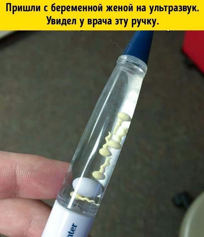 Пришли беременной женой на ультразвук Увидел у врача эту ручку