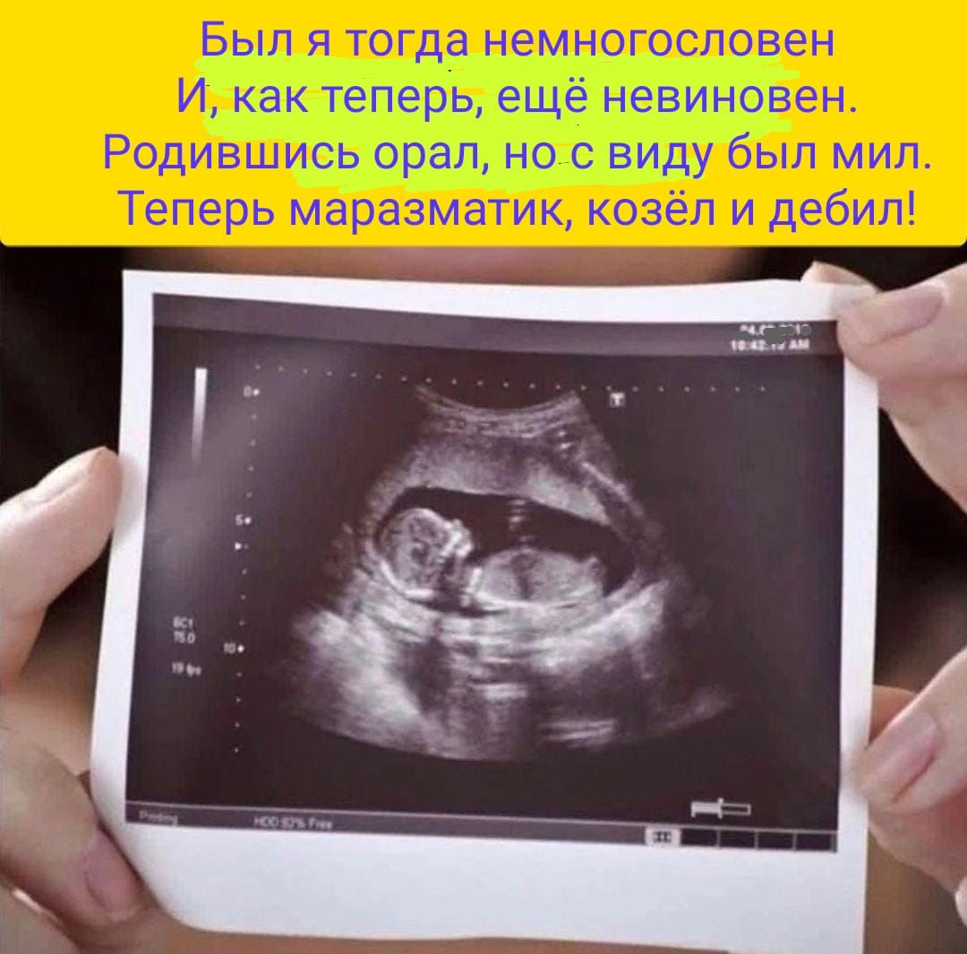 Был я тогда немиогословен И как теперь ещё невиновен Родившись орал но с виду был мц Теперь маразматик козёл и дебил
