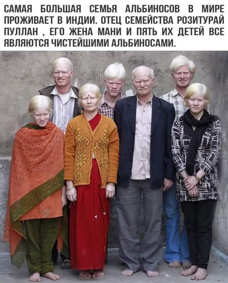 САМАЯ БОЛЬШАЯ СЕМЬЯ АЛЬБИНОСПВ В МИРЕ ПРОЖИВАЕТ В ИНДИИ ОТЕЦ СЕМЕЙСТВА РПЗИТУРАЙ ПУЛЛАН ЕГО ЖЕНА МАНИ И ПЯТЬ ИХ ДЕТЕЙ ВСЕ ЯВЛНЮТСЯ ЧИСТЕЙШИМИ АЛЬБИНПВАМИ Ц