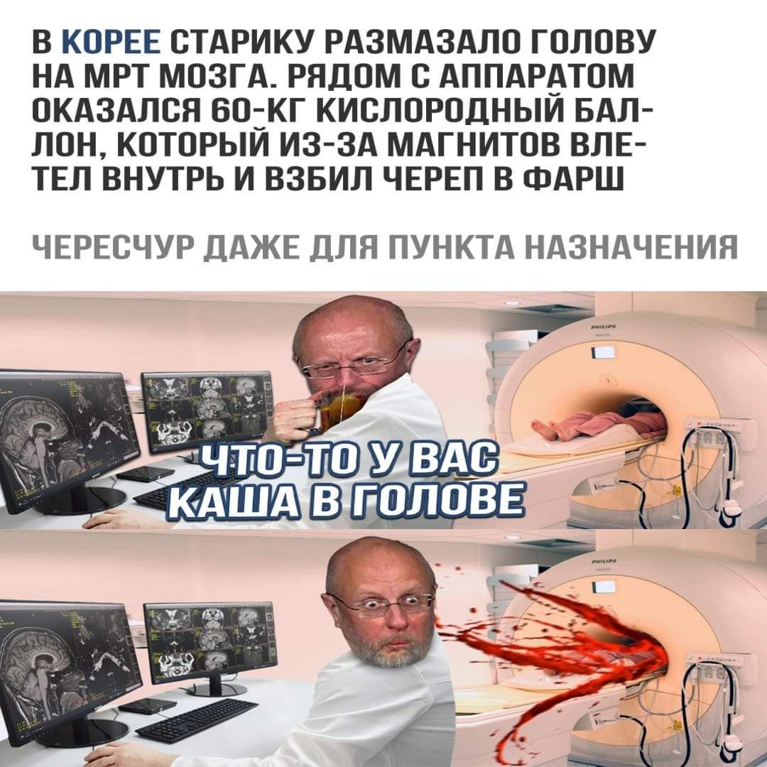 В КОРЕЕ СТАРИКУ РАЗМАЗАЛО ГОЛОВУ НА МРТ МОЗГА РЯДОМ С АППАРАТОМ ОКАЗАЛСЯ БОКГ КИСЛОРОДНЫИ БАЛ ЛОН КОТОРЫИ ИЗ ЗА МАГНИТОВ ВЛЕ ТЕЛ ВНУТРЬ И ВЗБИЛ ЧЕРЕП В ФАРШ ЧЕРЕОЧУР ДАЖЕ ДЛЯ ПУНКТА НАЗНАЧЕНИЯ