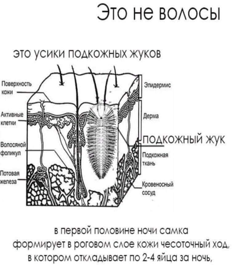 Это не ВОАОСЫ ЭТО УСИКИ ПОАКОЖНЫХ ЖУКОВ первой псдовине ночи сомко формирует в роговом САое кожи чесоточный ход в котором ОТКАОАЫБСЮТ по 2 4 яйцо за ночь