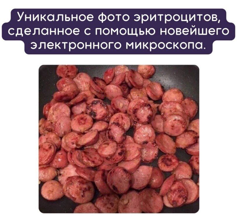Уникальное Фото эритроцитов сделанное с помощью новейшего электронного МИКРОСКОПО