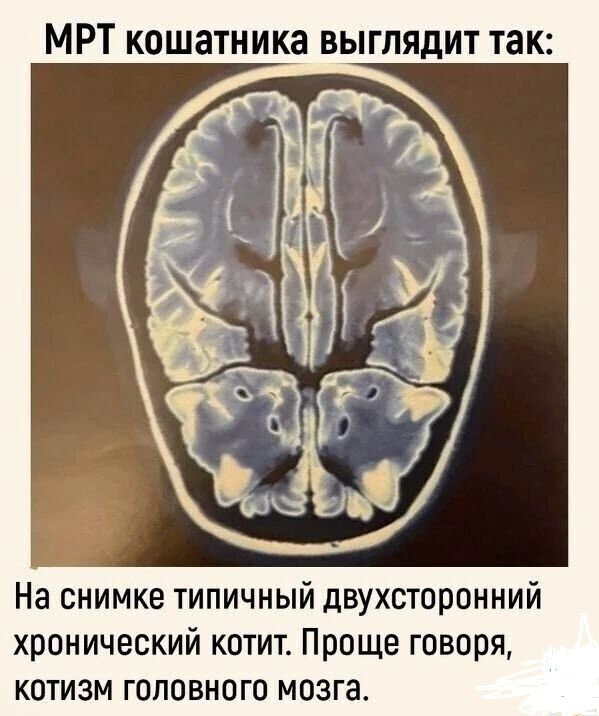 МРТ кошатника выглядит так На снимке типичный двухсторонний хронический котит Проще говоря котизм головного мозга