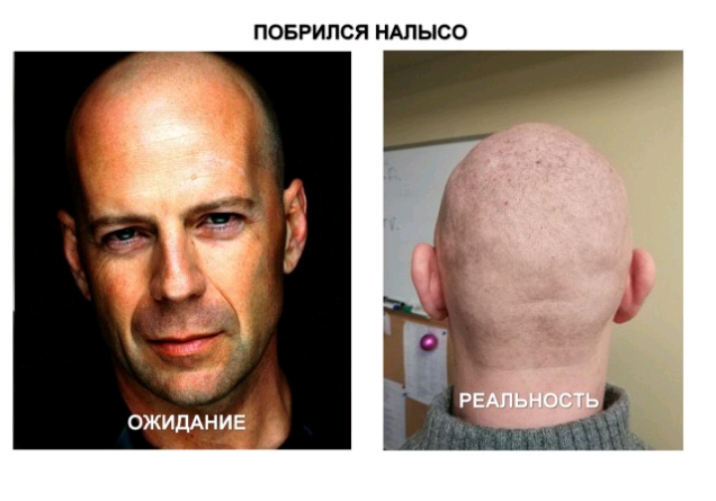 ПОБРИПСЯ НАЛЫСО