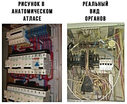 рисунок в шпьиыи Анппииткпи вид или пгглипв