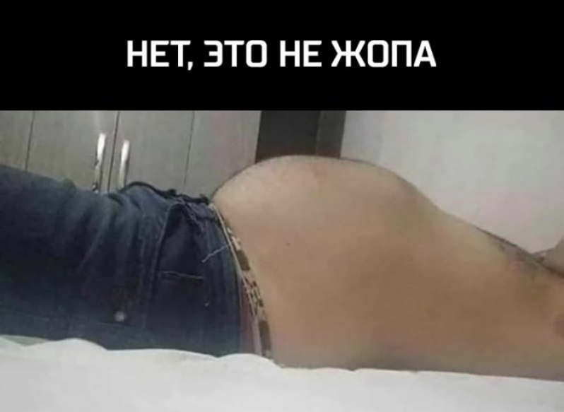 НЕТ ЭТО НЕ ЖОПА
