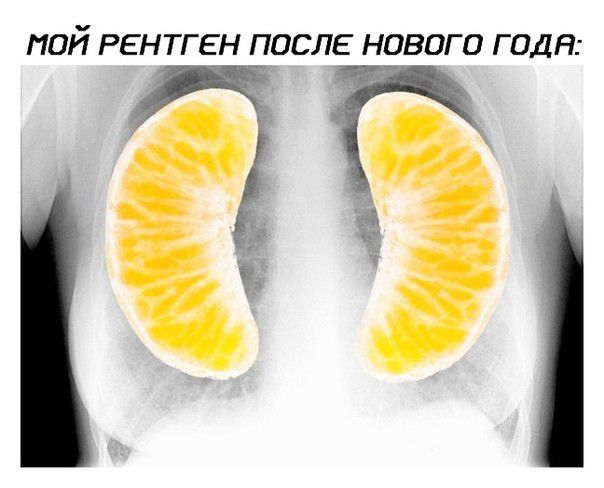 ПОЙ РЕНТГ ЕН ПОСЛЕ НОВОГО Г ОДН