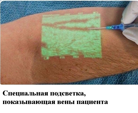 Специальная подсветка показывающая вены пациента
