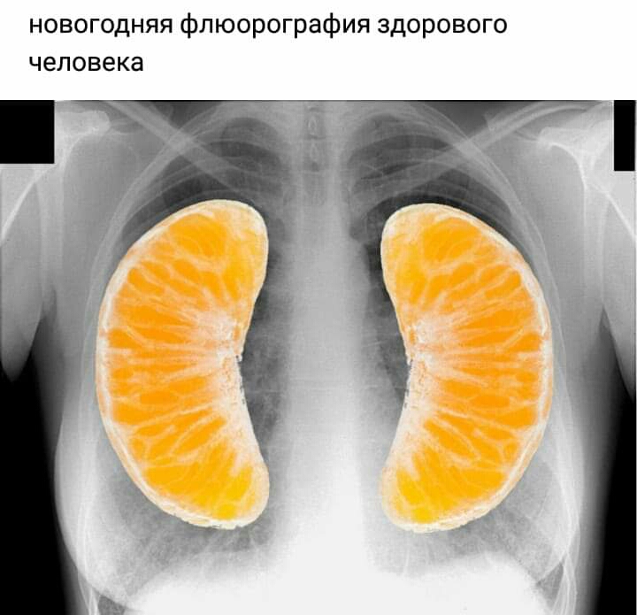 новогодняя флюорография здорового человека