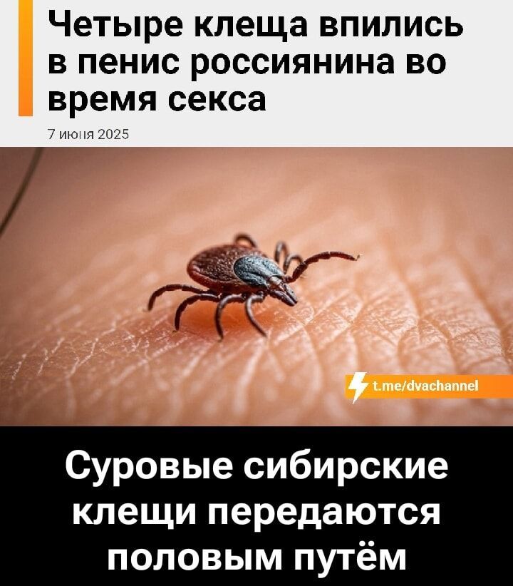 Четыре клеща впились в пенис россиянина во время секса
7 июля 2025
Суровые сибирские клещи передаются половым путём