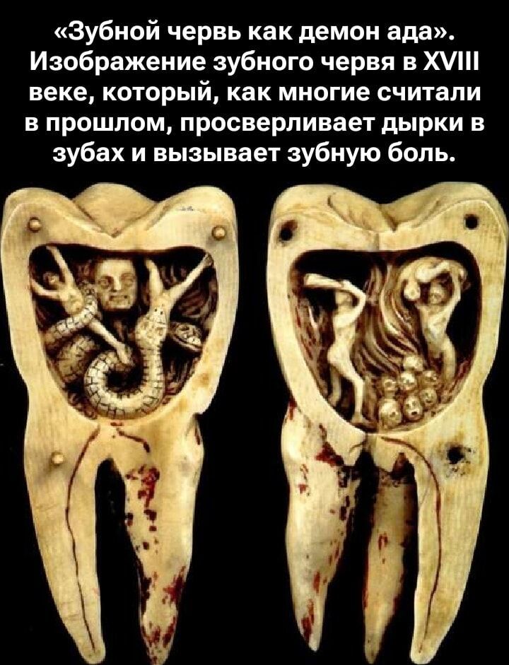 «Зубной червь как демон ада». Изображение зубного червя в XVIII веке, который, как многие считали в прошлом, просверливает дырки в зубах и вызывает зубную боль.