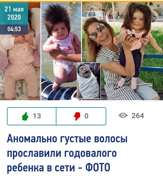 Аномально густые волосы прославили годовалого ребенка в сети ФОТО
