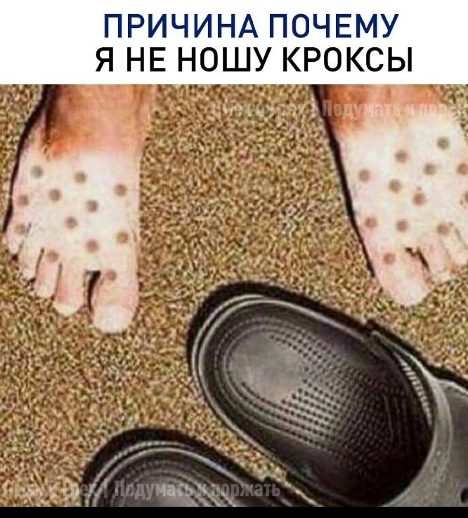 ПРИЧИНА ПОЧЕМУ Я НЕ НОШУ КРОКСЫ