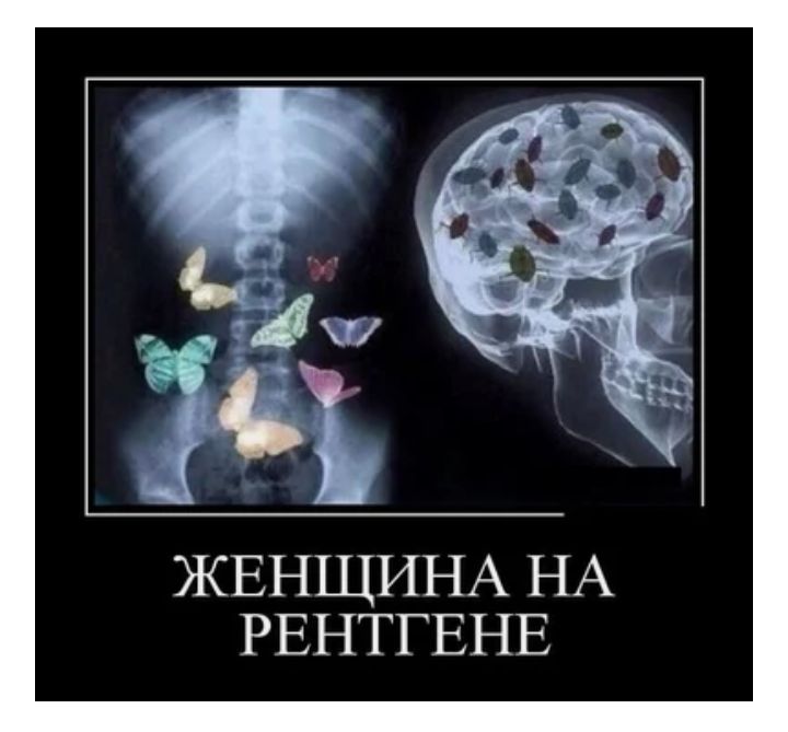 Ахх Ж_ЕНЩИНА НА РЕНТГЕНЕ