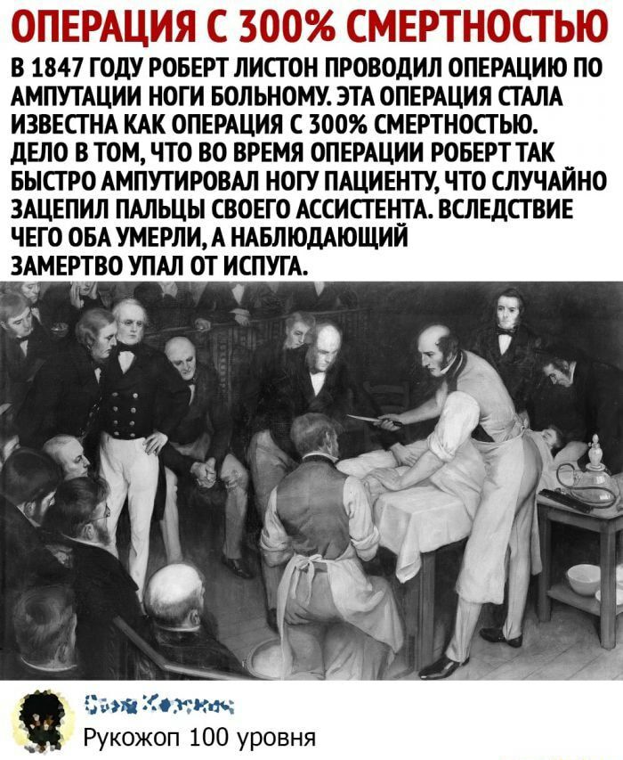 ОПЕРАЦИЯ С 300 СМЕРТНОСГЬЮ В 1847 ГОДУ РОБЕРТ ЛИСТ ОН ПРОВОдИП ОПЕРАЦИЮ ПО АМПУТАЦИИ НОГИ БОЛЬНОМУ ЭТА ОПЕРАЦИЯ СТАЛА ИЗВЕСГ НА КАК ОПЕРАЦИЯ С 300 СМЕРТНОСГЫО дЕЛО В ТОМ ЧТО ВО ВРЕМЯ ОПЕРАЦИИ РОБЕРТ ТАК _ БЫСТРО АМПУТИРОВАЛ НОГУ ПАЦИЕНТУ ЧТО СЛУЧАИНО ЗАЦЕПИЛ ПАЛЬЦЫ СВОЕГО АССИСГЕН_ТА ВСЛЕДСГВИЕ ЧЕГО ОБА УМЕРЛИ А НАБЛЮДАЮЩИИ ЗАМЕРТВО УПАЛ ОТ ИСПУГА ожидая Рукожоп 100 уровня