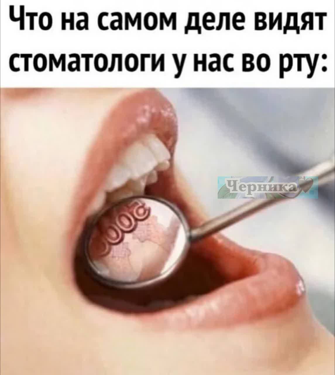 Что на самом деле видят стоматологи у нас во рту: