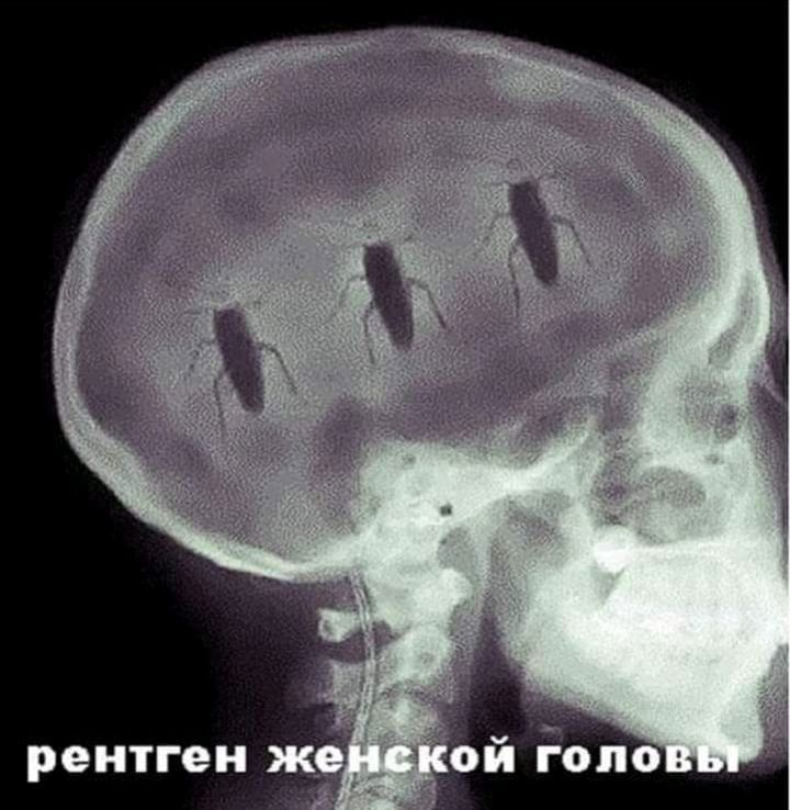 рентген