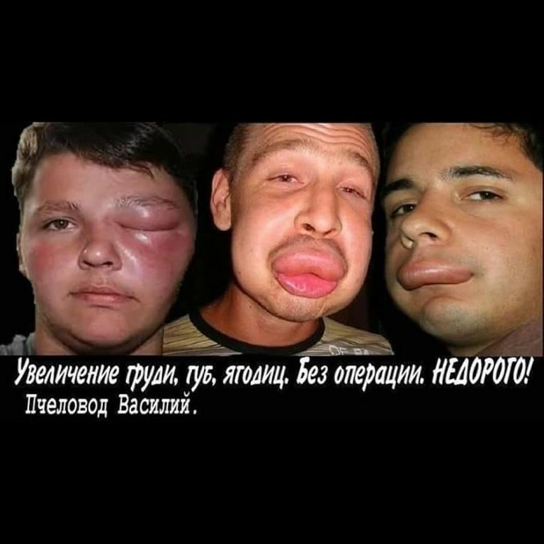 Увеличение груш 175 шлиц Пчеловод Василий