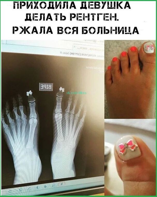 ПРИЖЭДИЛА ЛЕВУЩКА ЦЕПАТЬ РЕНТГЕН РКАЛА ВСЯ БОЛЬНИЦА и