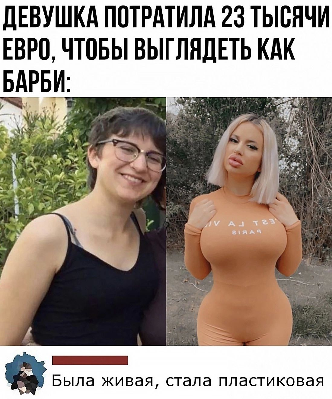 дЕВУШКА ППТРАТИЛА 23 ТЫСЯЧИ ЕВРП ЧТПБЫ ВЫГЛЯДЕТЬ КАК _ Была ЖИВЭЯ стапа ПЛЗСТИКОВЗЯ