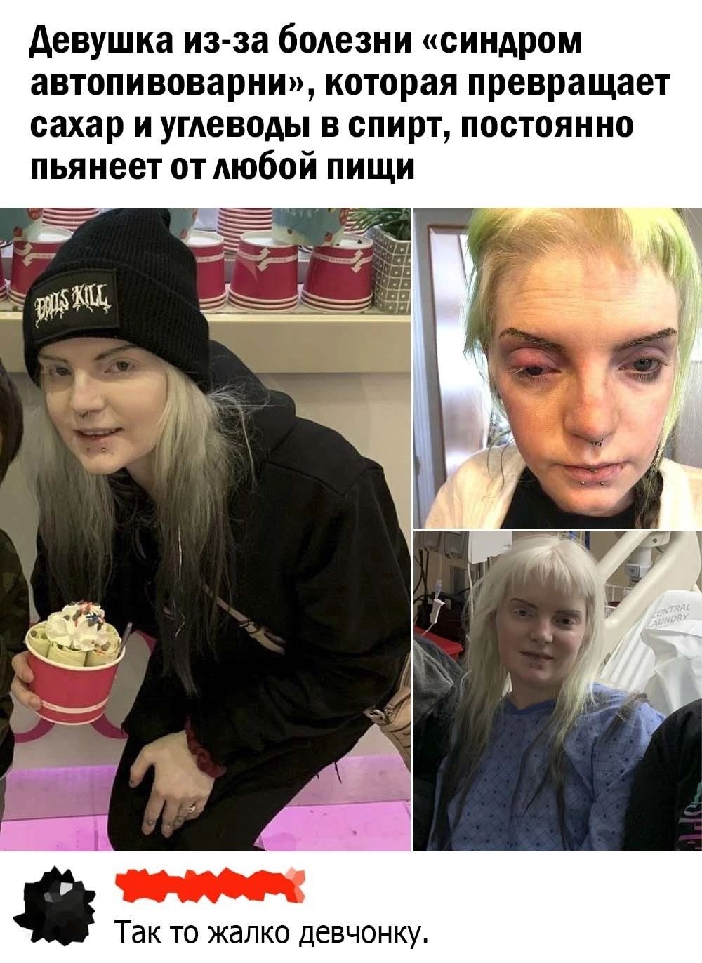 девушка из за болезни синдром автопивоварни которая превращает сахар и углеводы в спирт постоянно пьянеет от мобой пищи Так то жалко Девчонку